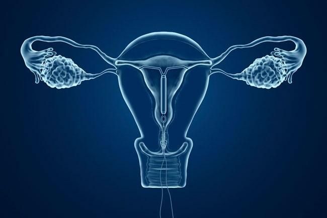DRA. SILVIA PATRICIA MARTÍNEZ JIMÉNEZ- atención ante endometriosis en Mexicali