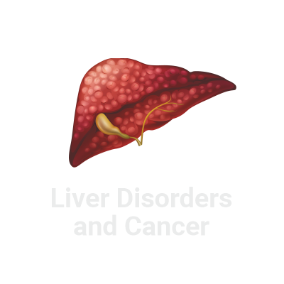 Liver Disorders and Cancer Crowdfunding - Liver Pancreas Foundation of Hyderabad, LPFOH