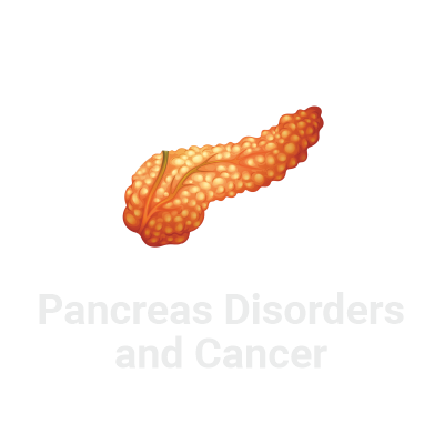 Pancreas Disorders and Cancer Crowdfunding - Liver Pancreas Foundation of Hyderabad, LPFOH