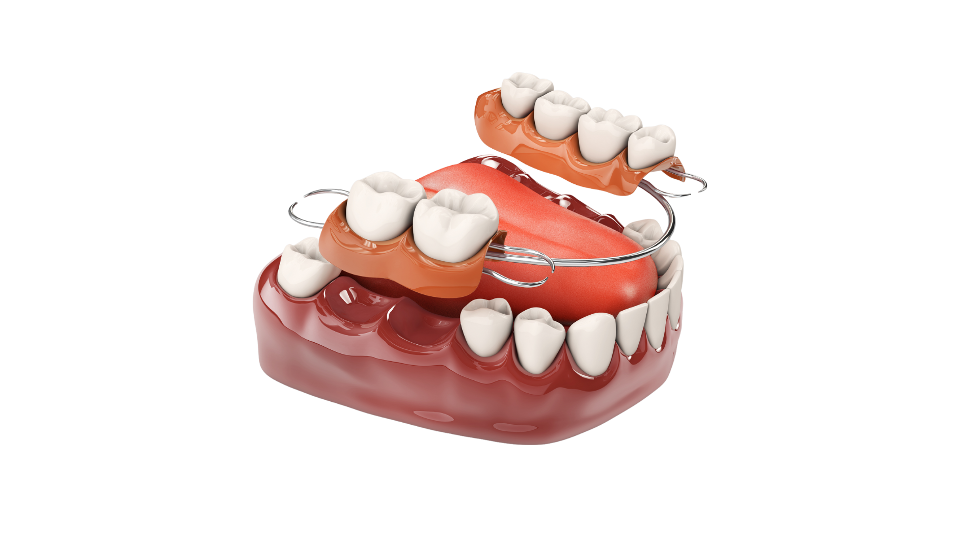 3d image of dentures
