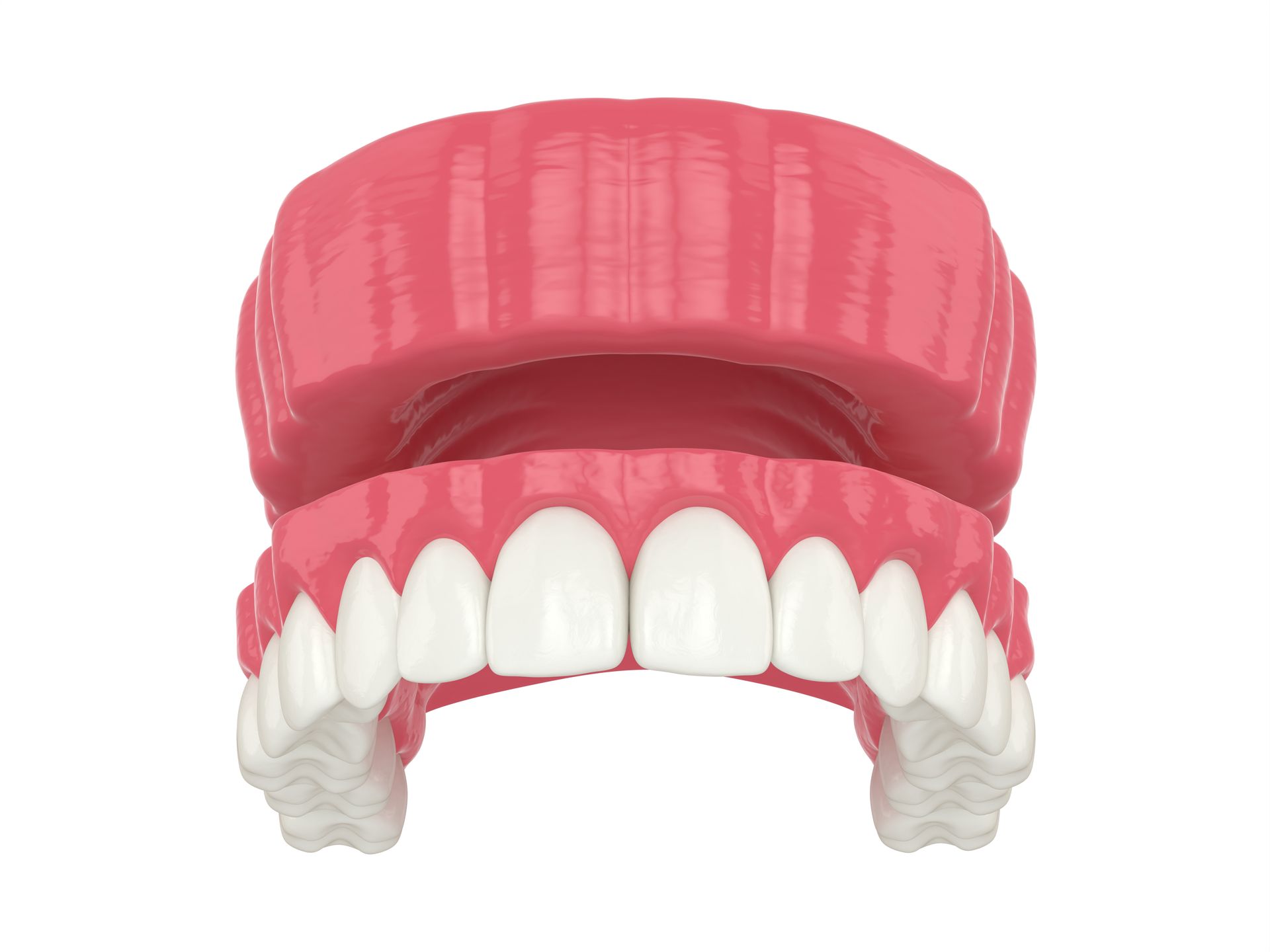 3d image of traditional denture