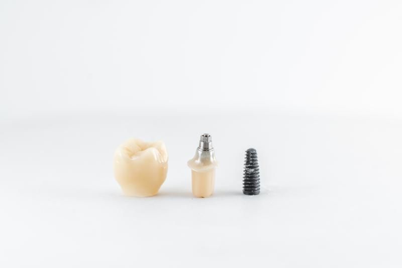 various types of dental implants