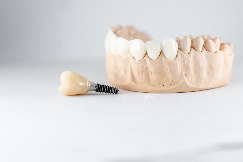 jawbone with and without dental implants