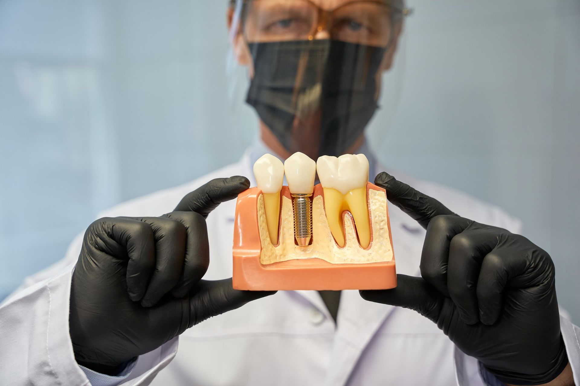 A dentist wearing a mask and black gloves is holding a model of a tooth implant