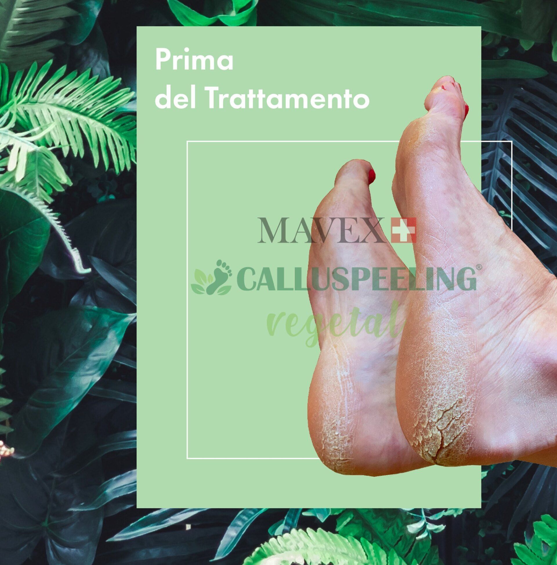 Una foto dei piedi di una persona con la scritta