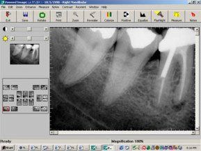 Gentle Touch Family Dentistry - Digital X-Rays