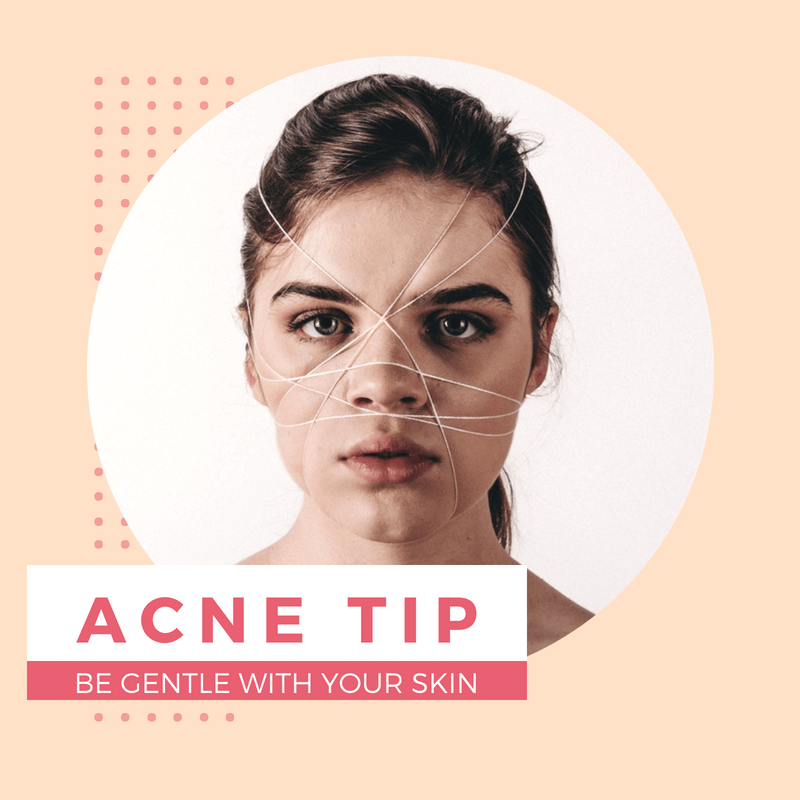 Acne Tip: Be Gentle with Your Skin