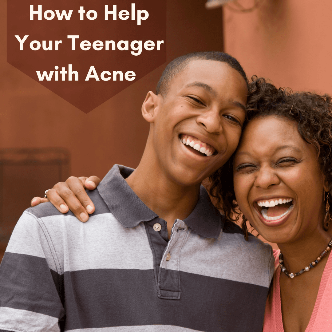 How to Deal with Acne as a Parent