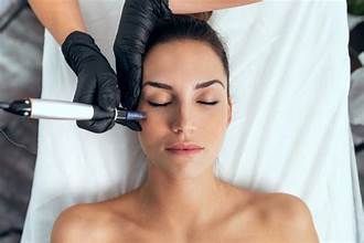 Person receiving a microneedle facial treatment; 