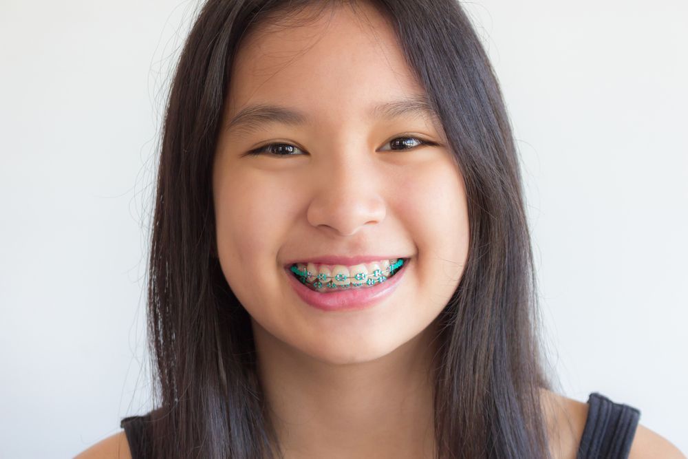 Young Girl With Braces On Her Teeth Smiling — Dentist On Tweed in Tweed Heads, NSW