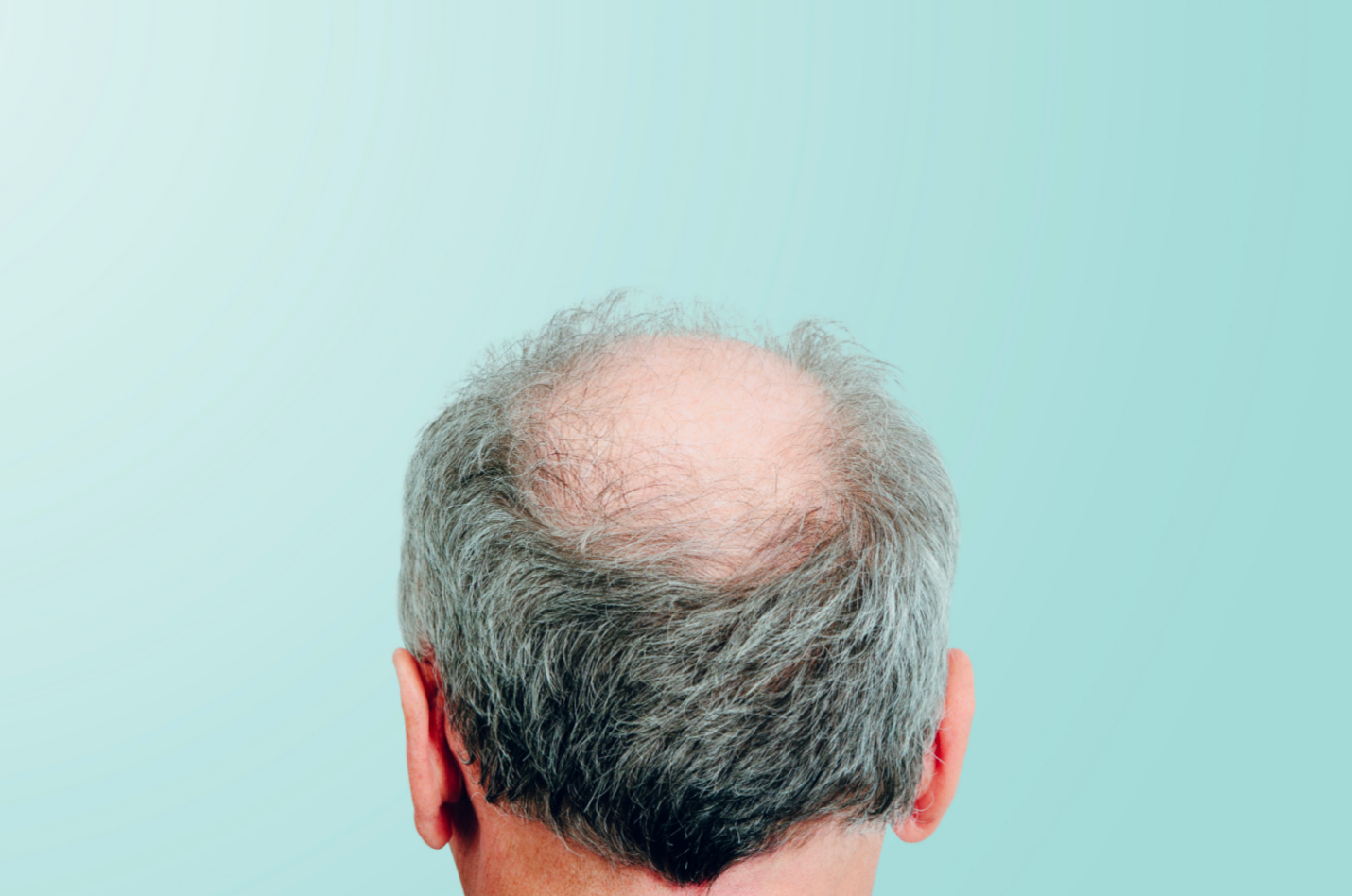 Back of a man's head with thinning gray hair and a bald spot against a light blue background.