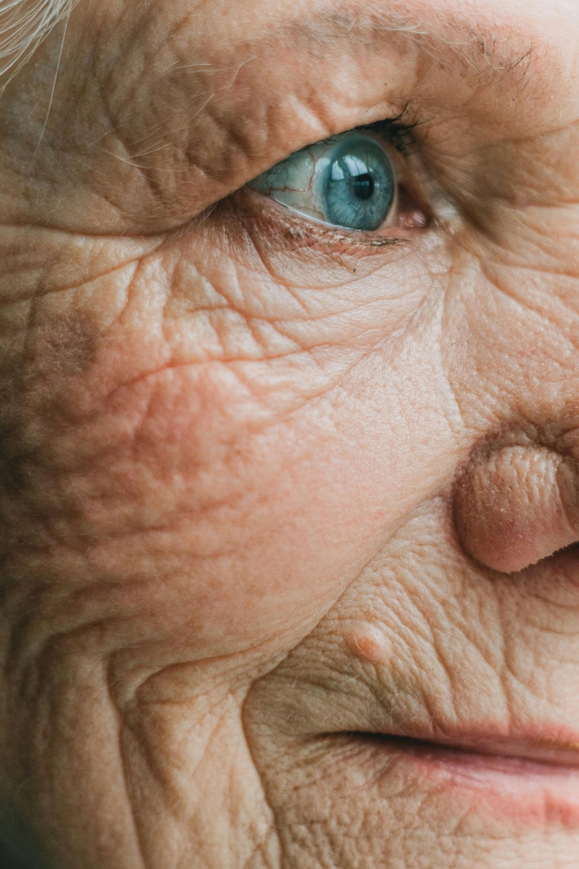 Close-up of an elderly person's face, showing a blue eye and wrinkled skin.