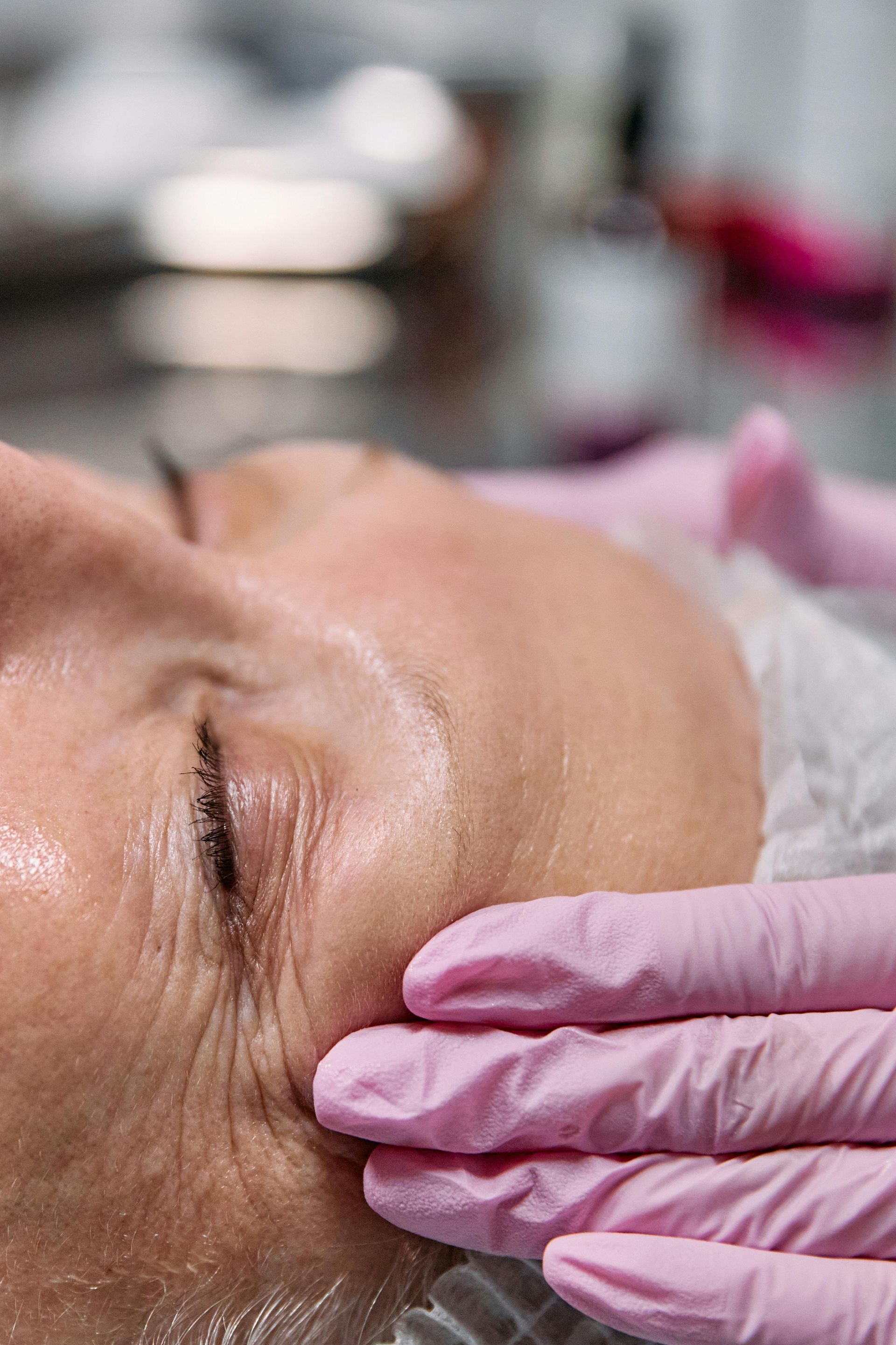 Close-up of person's face receiving facial treatment, gloved hands gently touching skin. Wrinkles are visible.