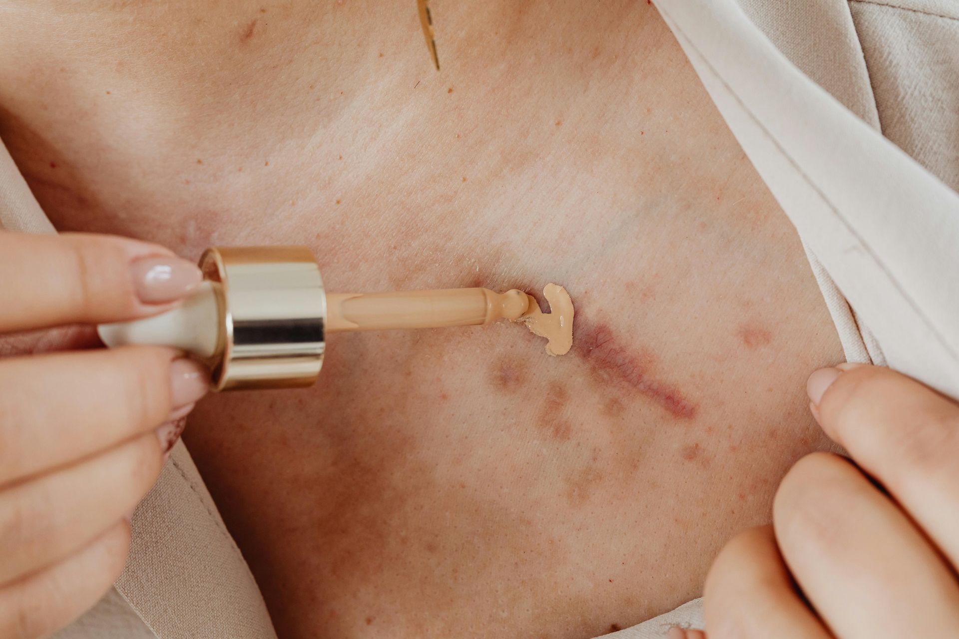 Person applying foundation to chest, concealing scars and blemishes with a dropper.