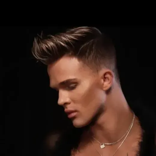 photo of 8 Months After, Jaw Filler, Cheek Filler, Lip Filler, Monaco med spa, Miami, FL, edgewater miami, midtown miami, male botox, male fillers, brotox, jaw contouring, cheek contouring, before and after, radiesse, juvederm, restylane Monaco med spa in downtown worldcenter edgewater midtown Miami, FL