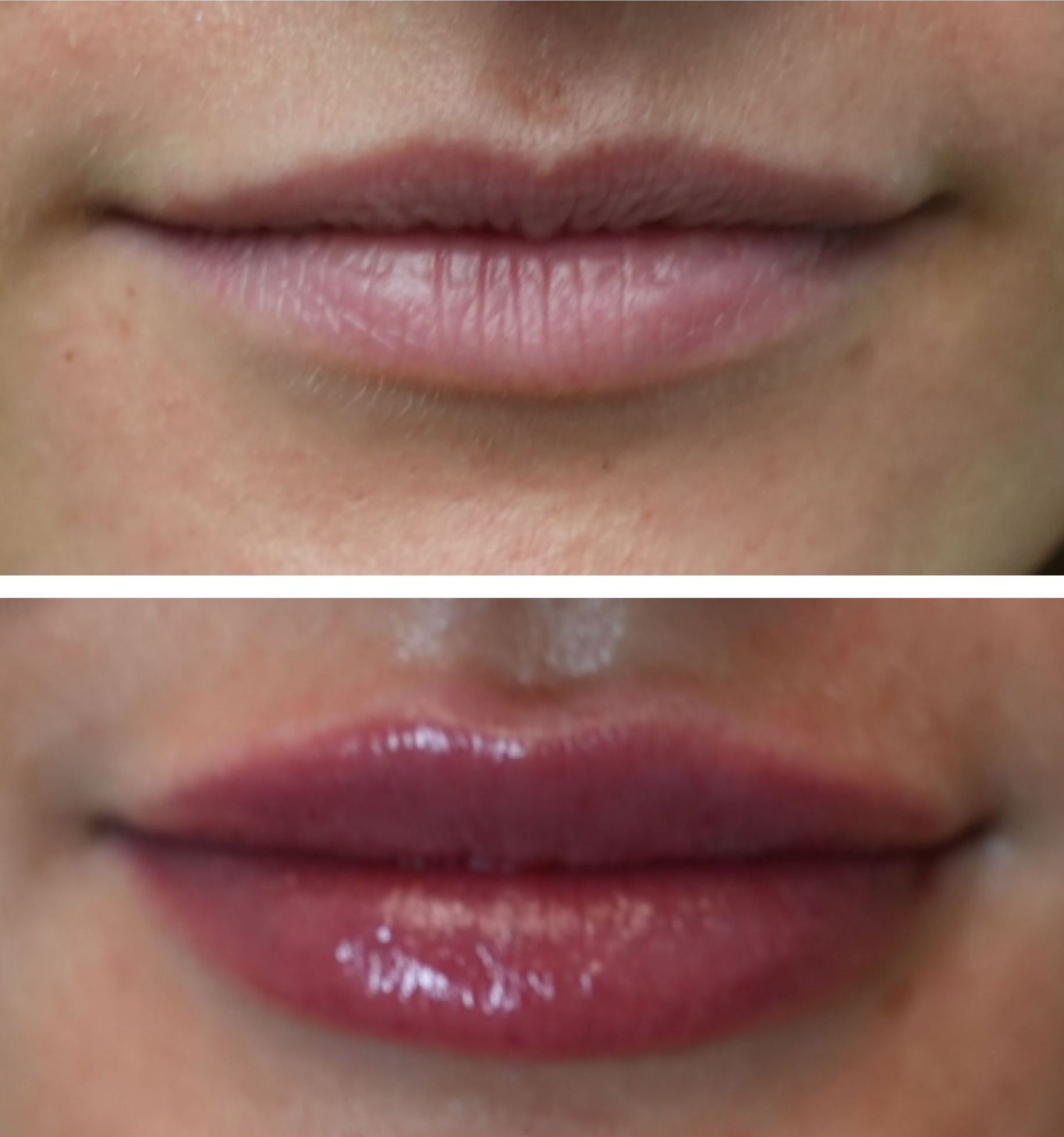 A before and after picture of a woman 's lips.