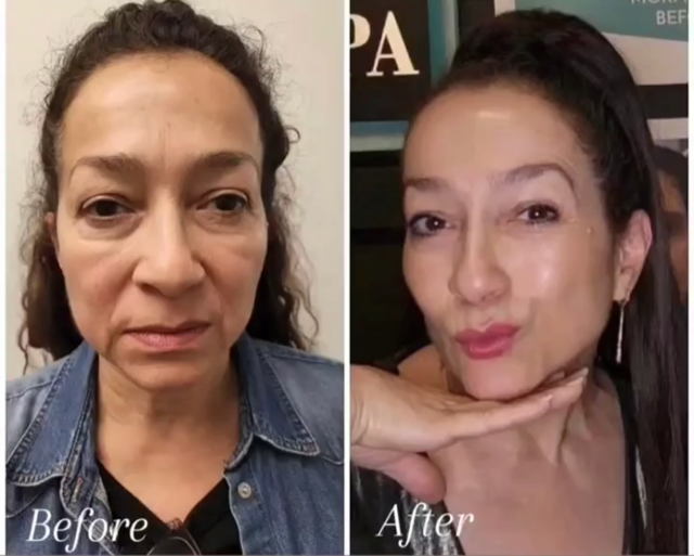 A before and after photo of a woman 's face