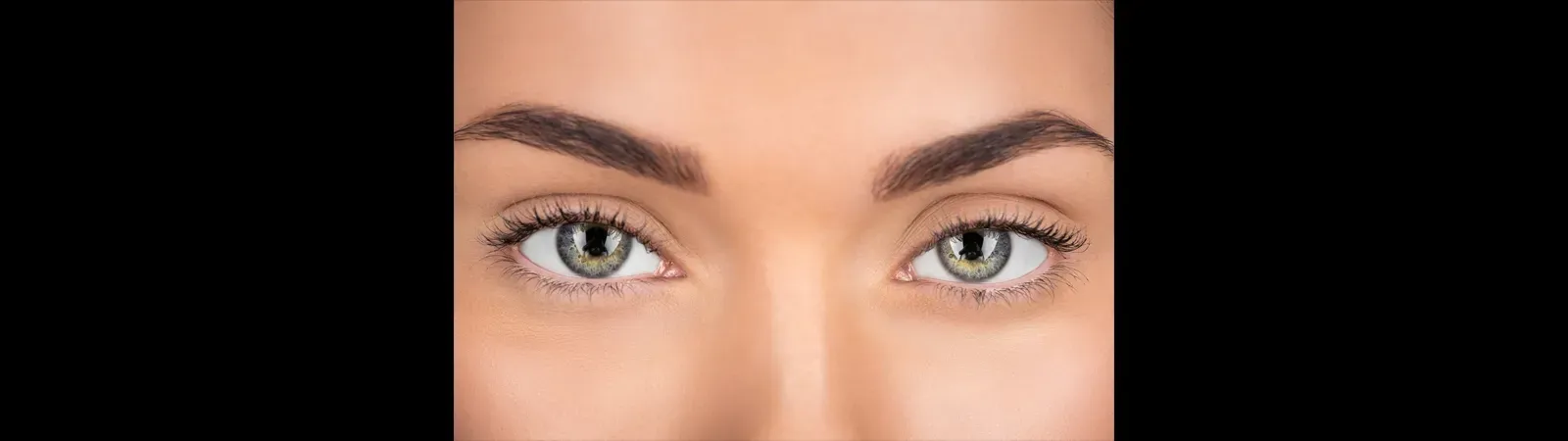 Tear trough, eyelid filler, morpheus8, plasma pen before and after, Monaco MedSpa, Miami, FL.