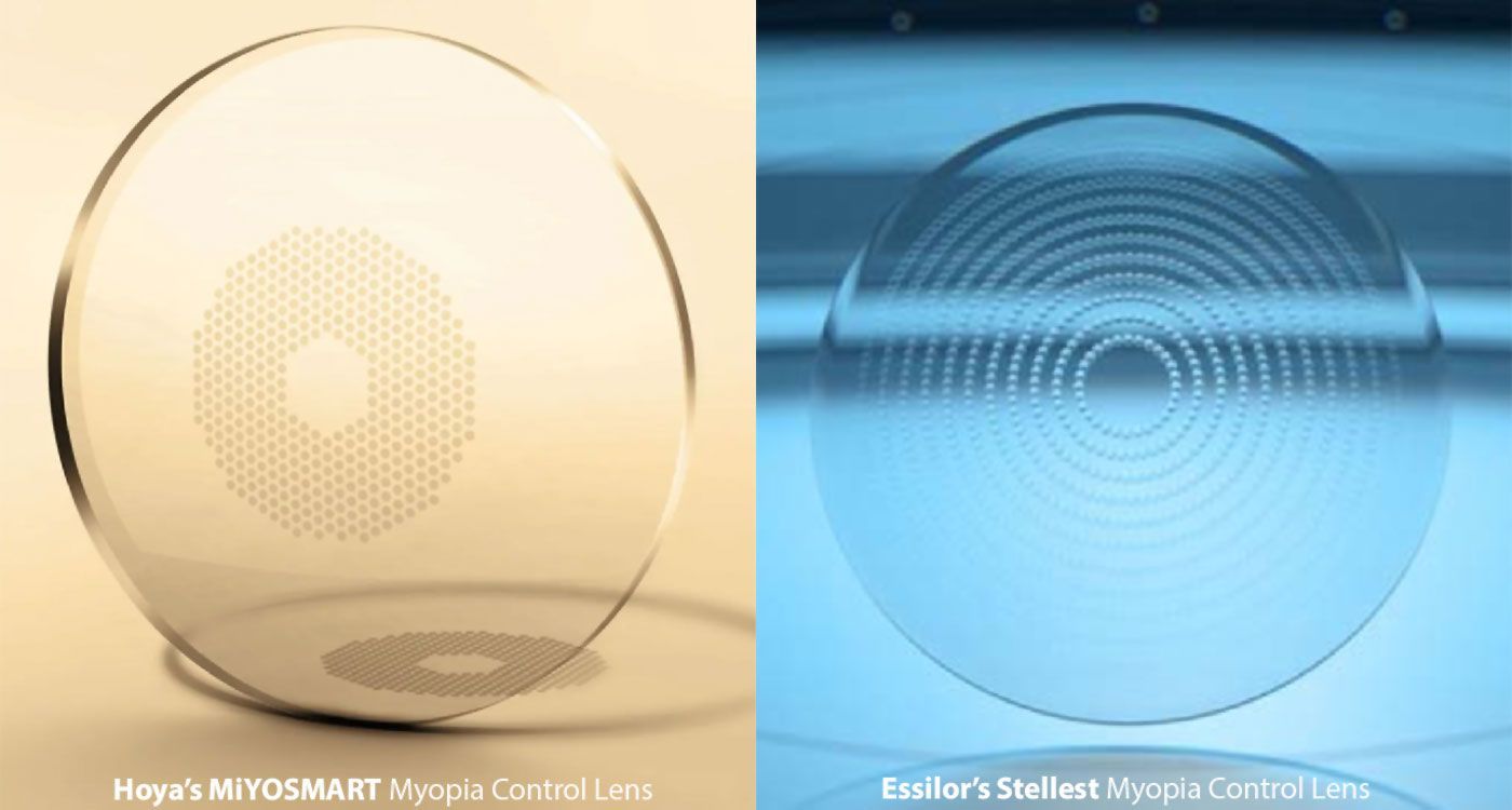 lenti MiyoSmart e Stellest