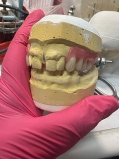 A Person Wearing pink Gloves Is Working On A Model Of Teeth — Partial Dentures in Central Coast, NSW