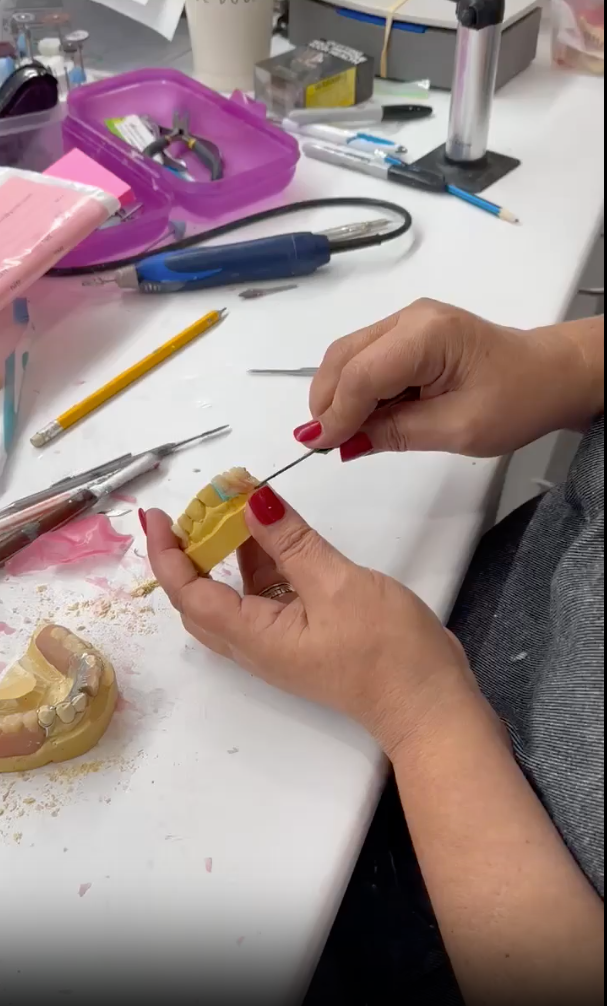 A Dentist Is Working On A Model Of A Person 's Teeth — Full Dentures in Central Coast, NSW
