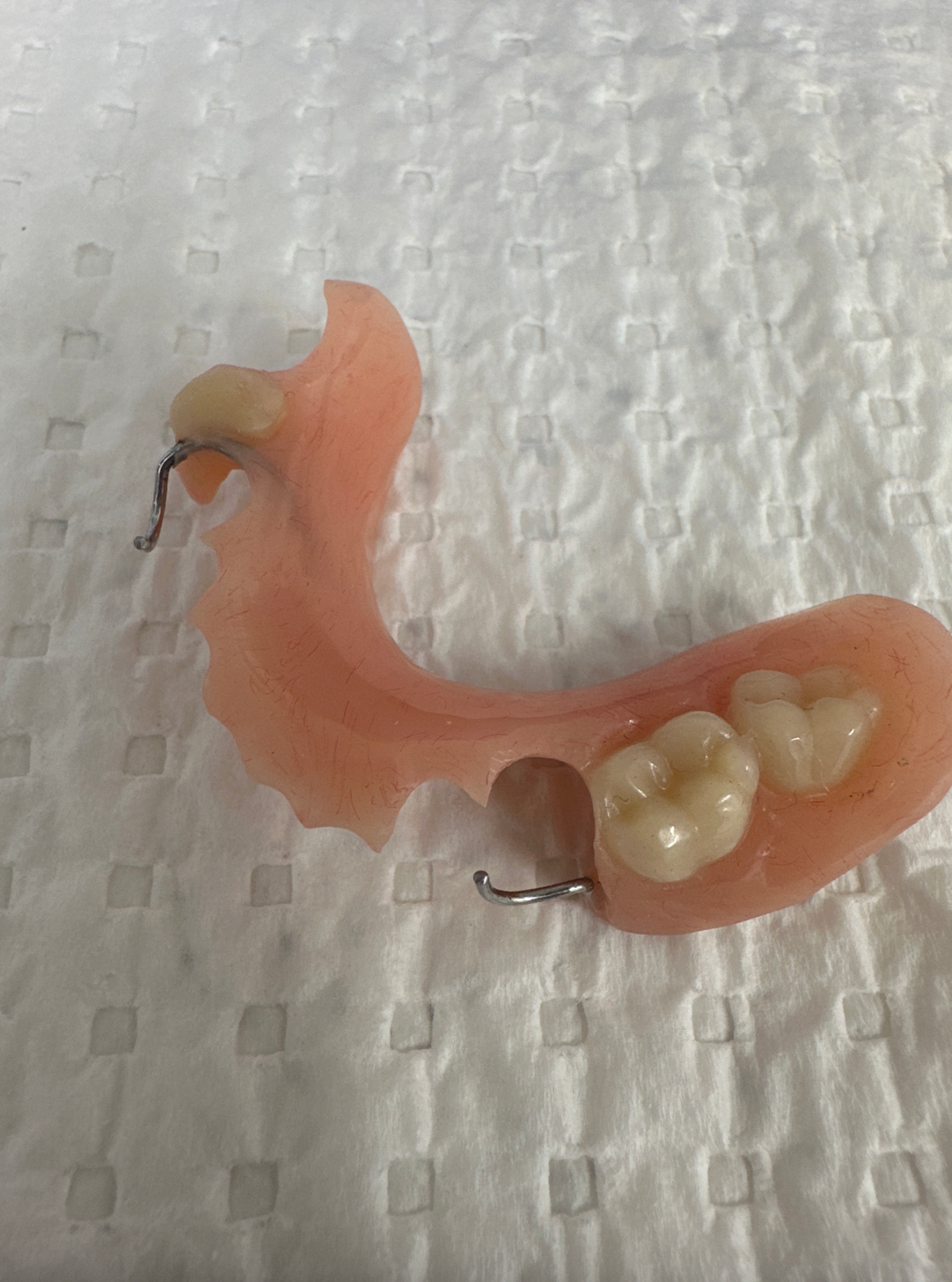 Row of teeth on a white paper towel  — Denture Adjustments in Central Coast, NSW