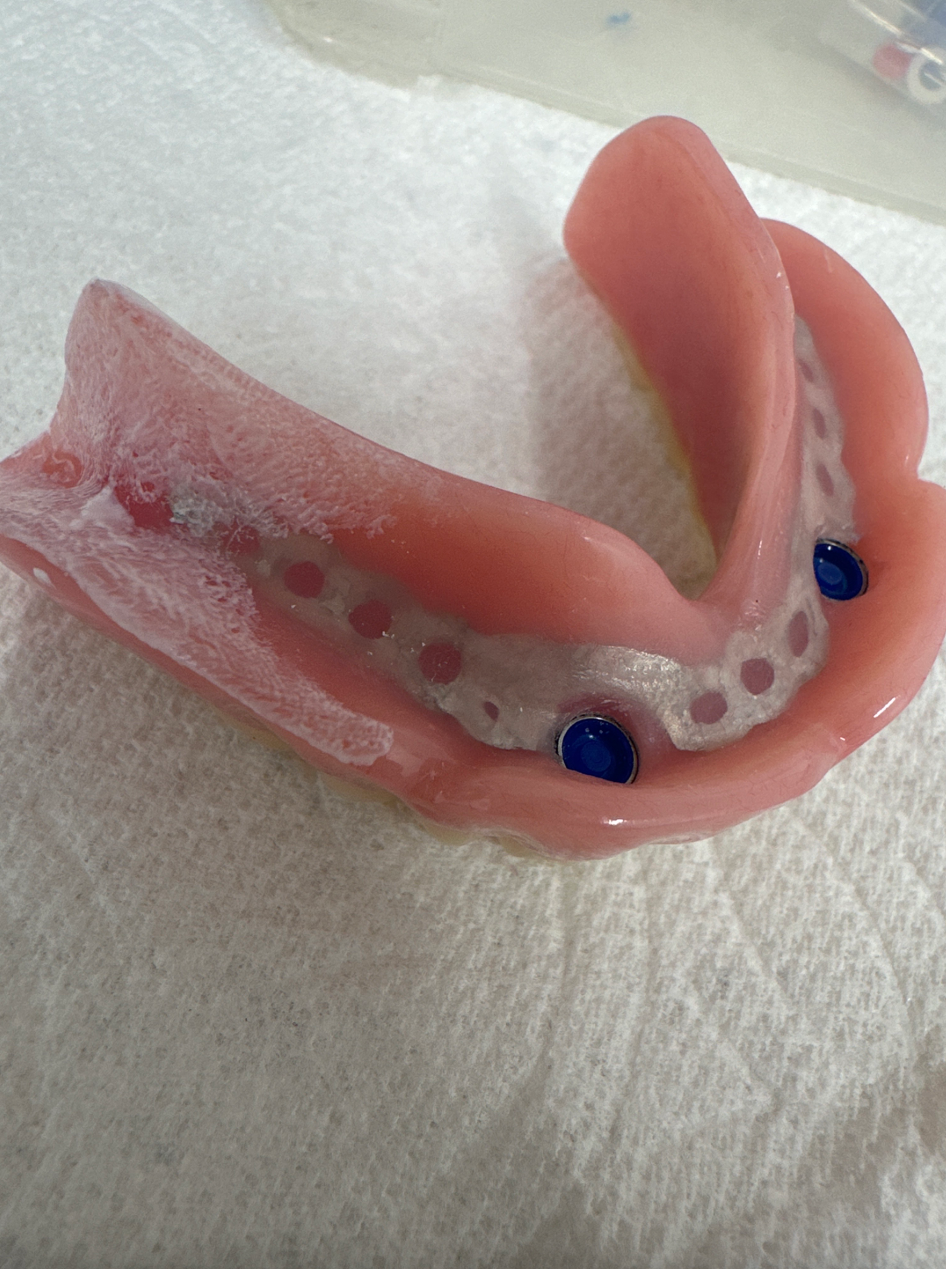 Mouth adjustment sitting on paper towel  — Denture Adjustments in Central Coast, NSW