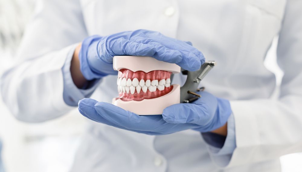 A Dentist Is Holding A Model Of Teeth In His Hands — Dentures in Gosford, NSW