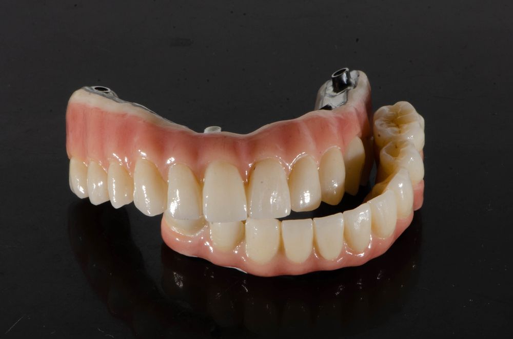 A Full Denture Is Placed On A Black Surface — Dentures in Glendale, NSW