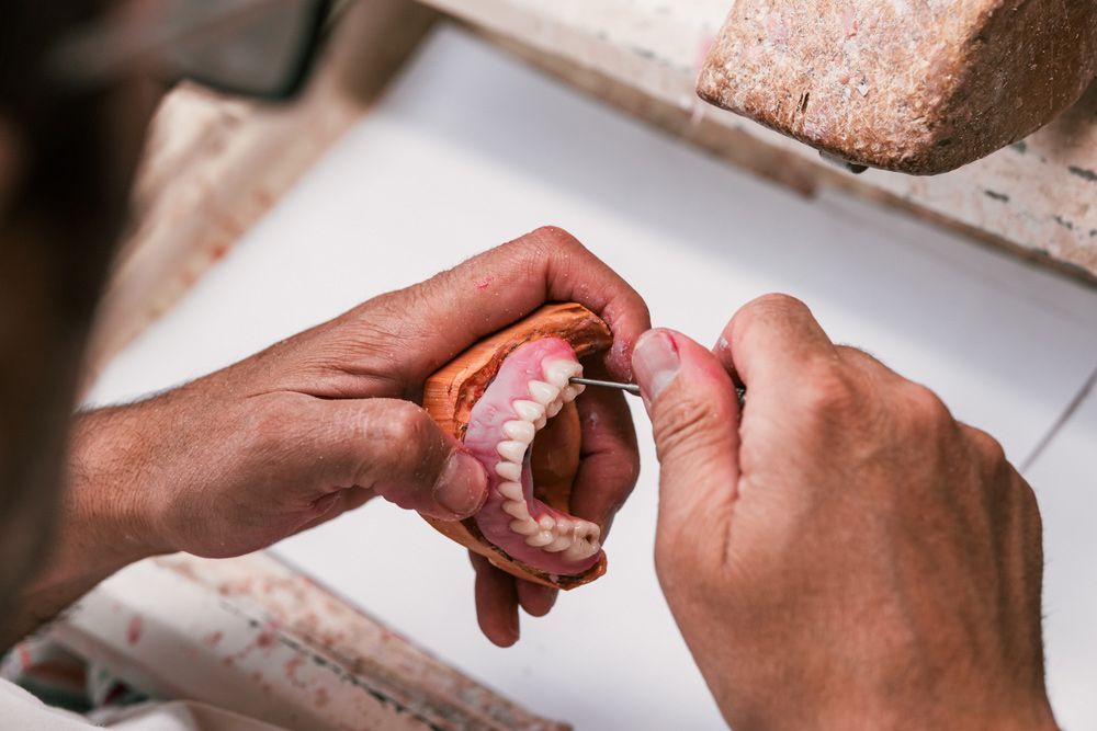 A Man Is Working On A Denture With A Metal — Dentures on the Central Coast, NSW