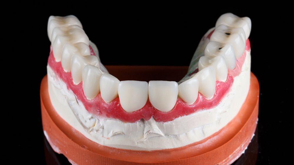 A Model Of A Person's Denture On A Black Background — Dentures in Gosford, NSW