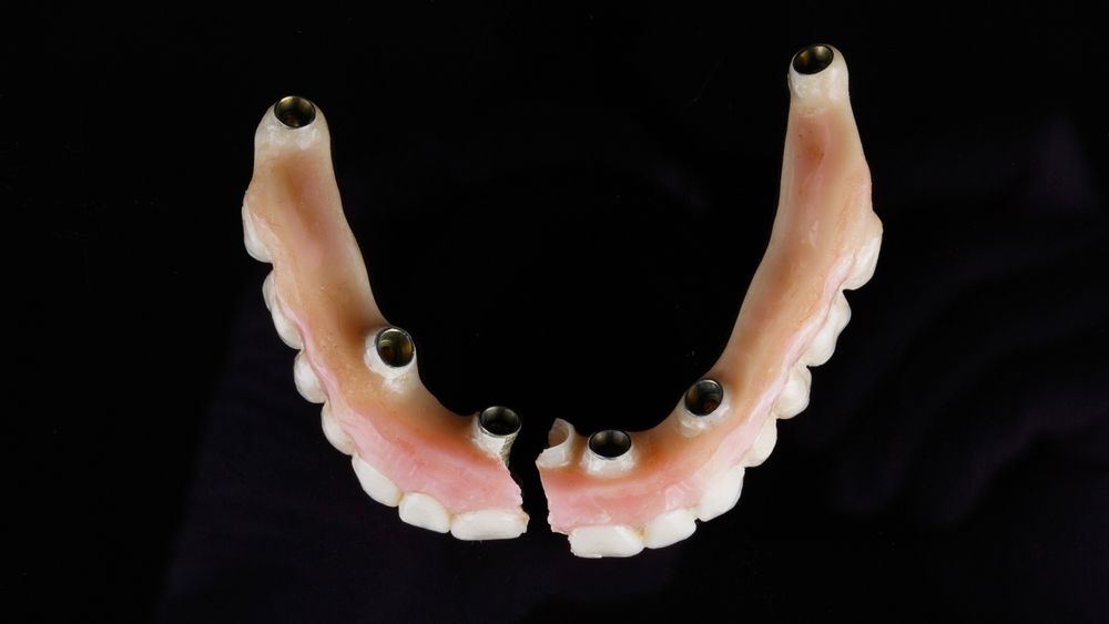 A Close Up Of A Broken Denture On A Black Background — Dentures in Glendale, NSW