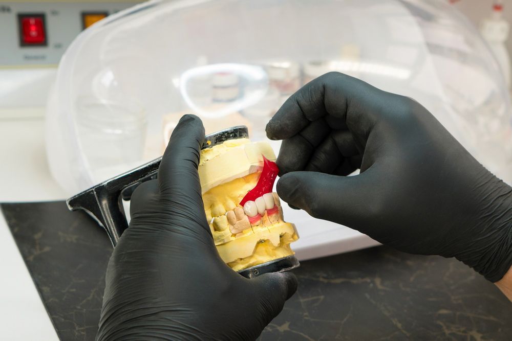 A Person Wearing Black Gloves Is Holding A Model Of Denture — Dentures in Port Macquarie, NSW