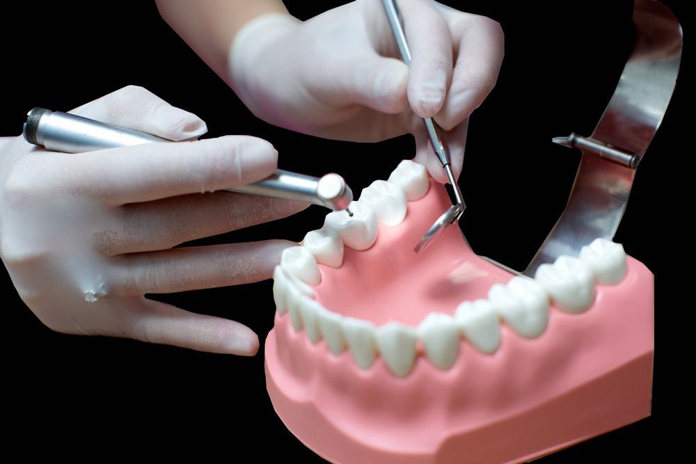 A Dentist Is Working On A Model Of Denture Using Tools — Dentures in Gosford, NSW