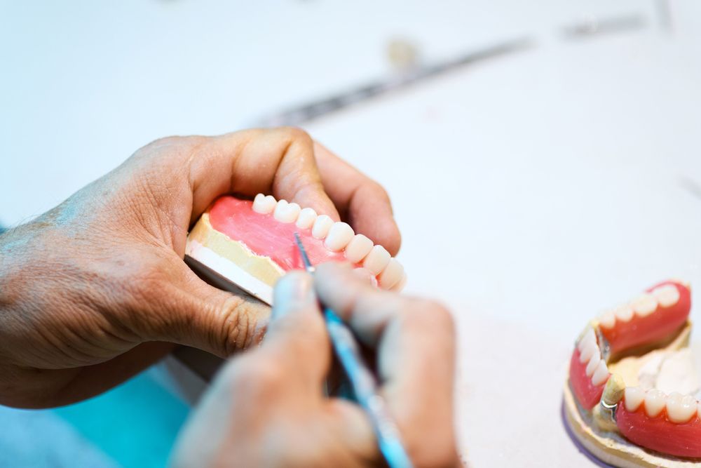 A Dentist Is Working On A Model Of A Person's Teeth — Denture Repairs in Central Coast, NSW