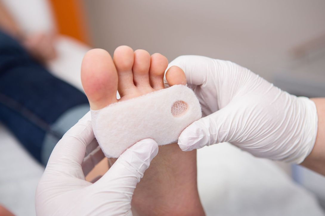 Cura patologie del piede