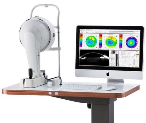 INSTITUTO VISUAL DR DAVID MÉNDEZ S.C - Previo a la cirugía