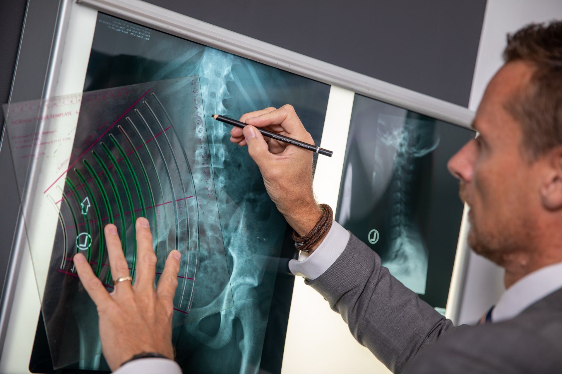 Chiro identifying issues on an xray