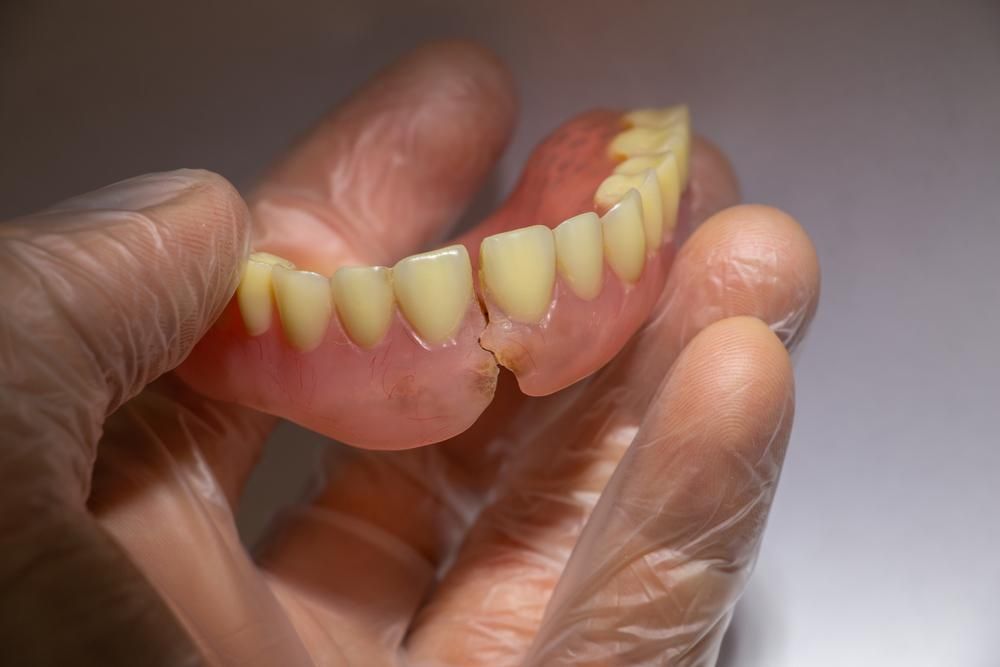 A Person Is Holding a Broken Denture in Their Hand — Steve King Dental Group in Manunda, QLD