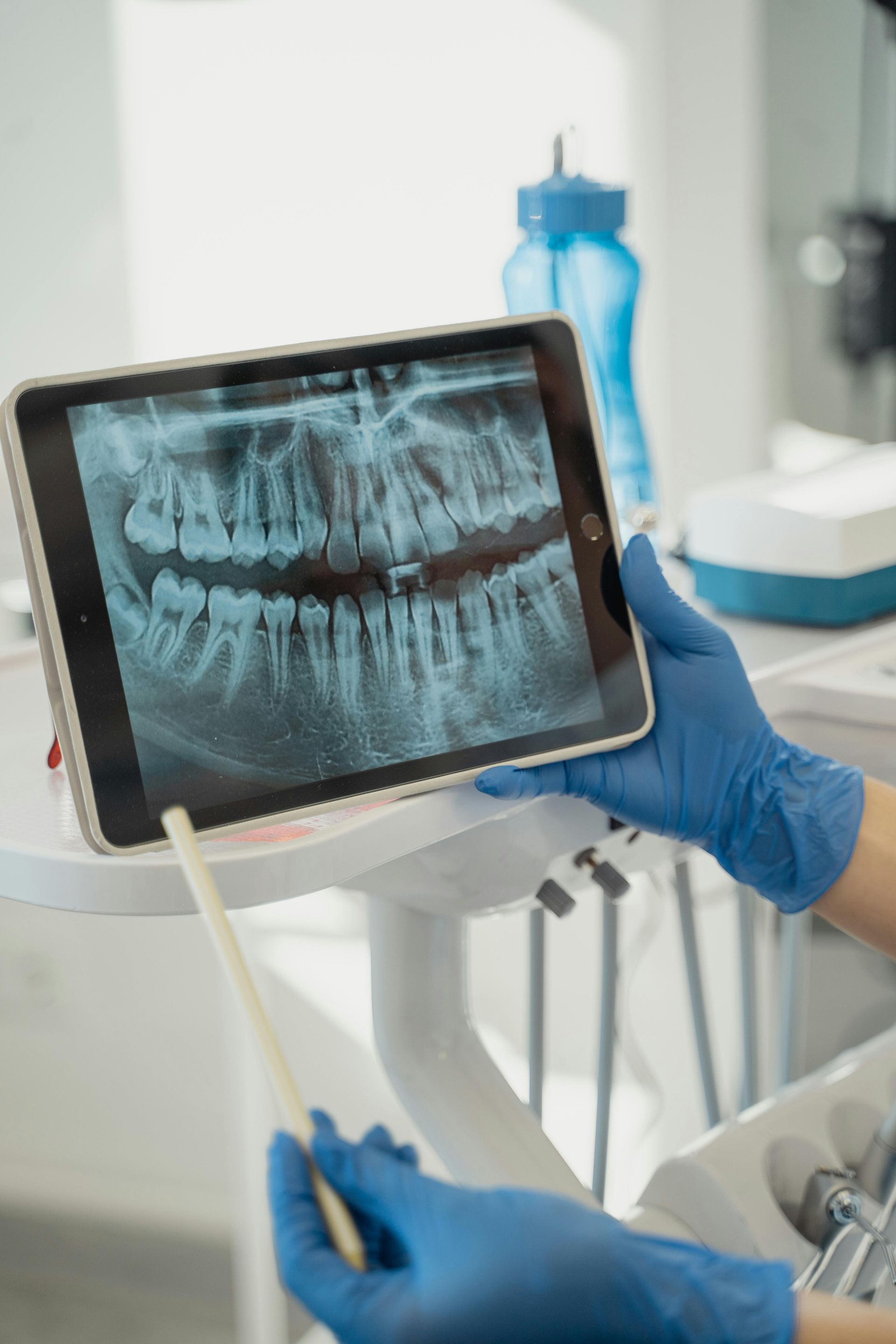 A Dentist Is Looking At An X-ray Of A Patient 's Teeth On A Tablet — Steve King Dental Group in Manunda, QLD