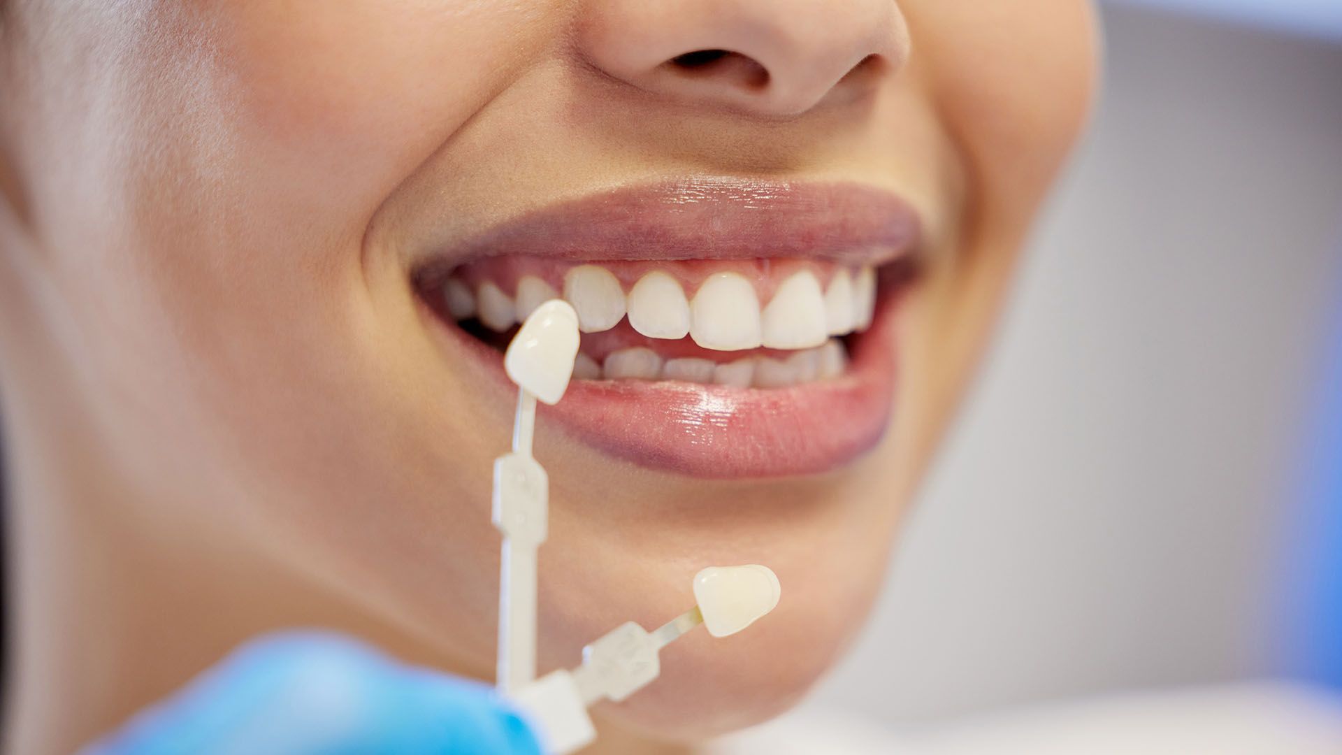Woman smiling, holding dental veneer samples up to her teeth in a dental setting