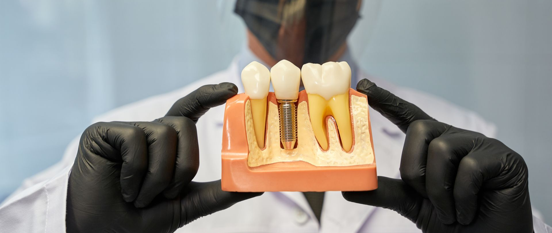 Dentist in black gloves holding a model of teeth with a dental implant.