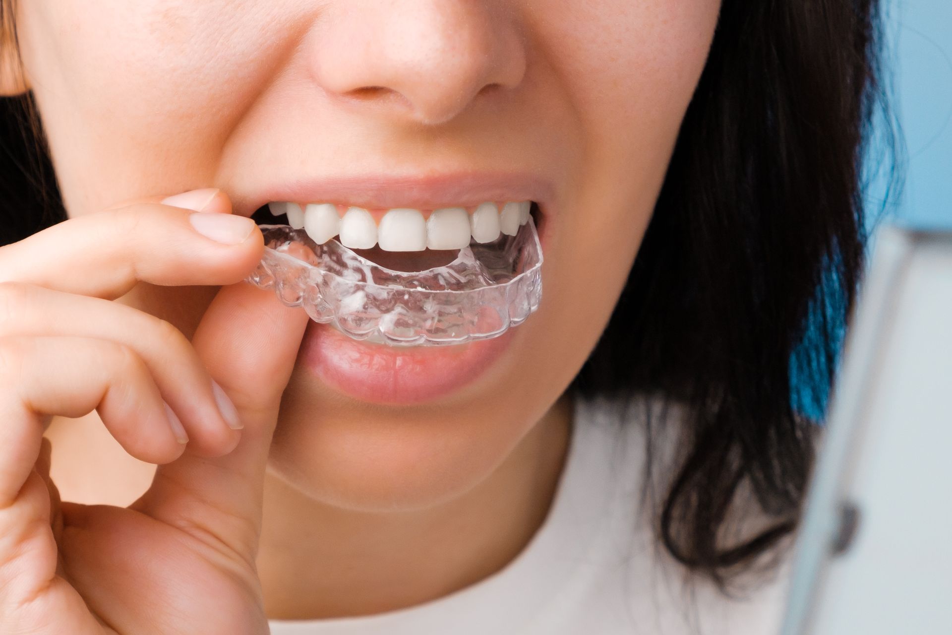 Woman putting in a clear aligner for teeth, white teeth are visible, light blue background.