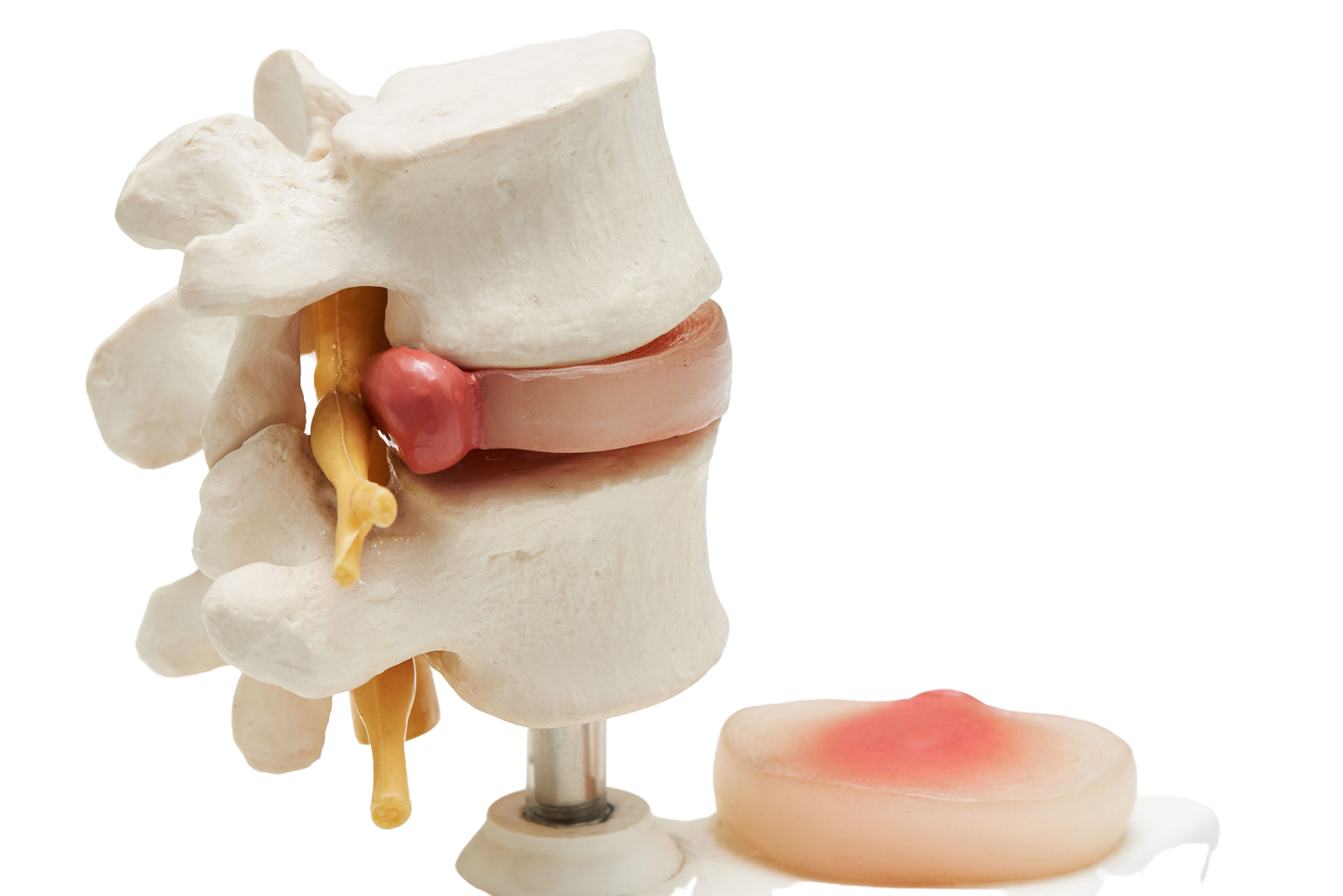 accident injury specialist