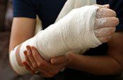 Injured arm - General Practice Attorneys in Montesano, WA