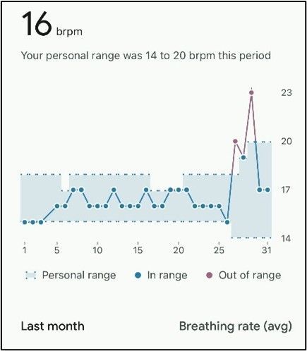 Wearable data changes when getting sick