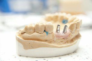 Denture repairs