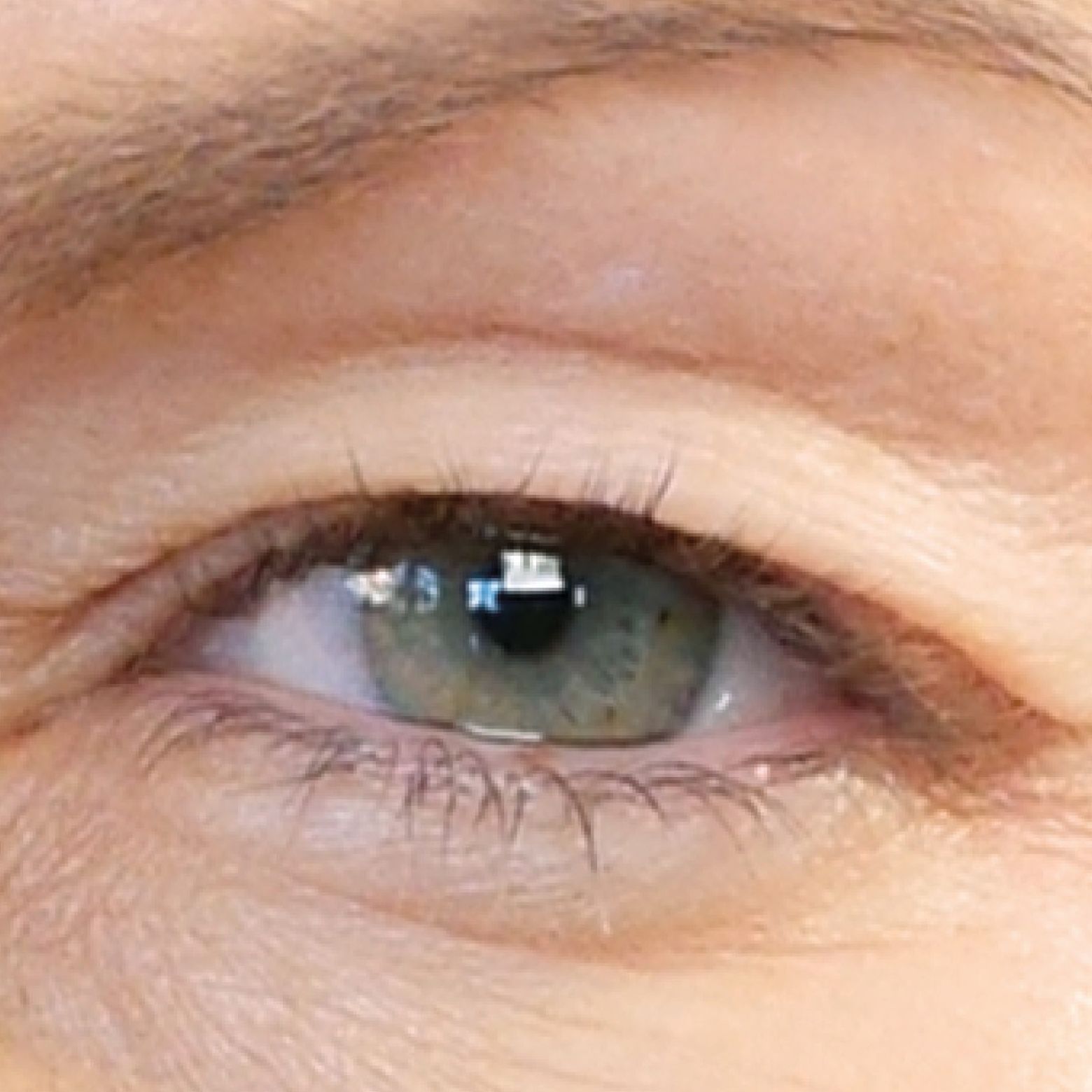 a close up of a woman 's green eye with long eyelashes before treatment