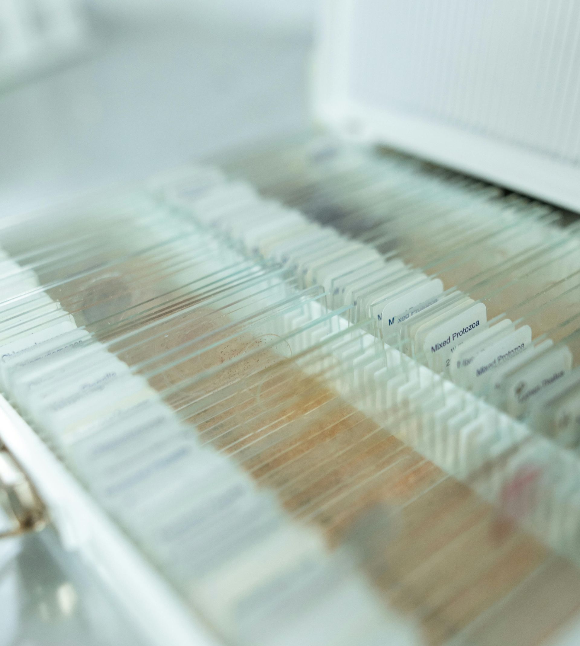 Microscope slides in a white container, displaying tissue samples.