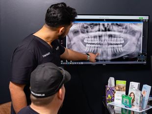 Dentist explaining root canal process